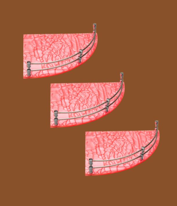 STIMULUS pink acrylic bathroom corner shelf set of 3, 10x10 inch, water-resistant and rust-proof, perfect for bathroom and kitchen storage and organization.
